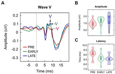 The frequency-following response in late preterm neonates: a pilot study